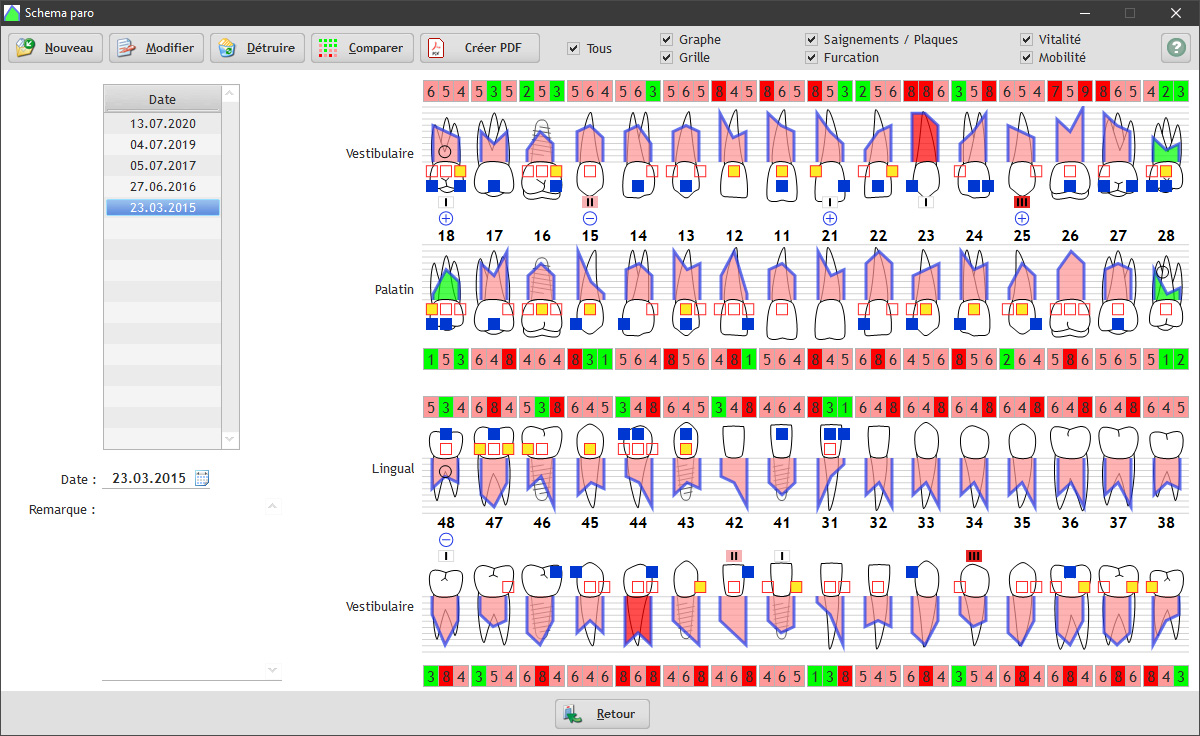 Le schéma paro de notre logiciel Easygest pour dentiste est très complet